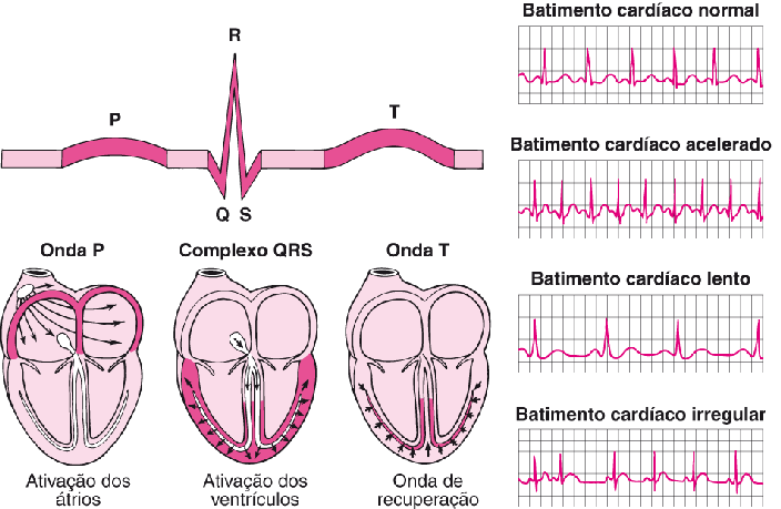 Como Ler Um Eletrocardiograma Em 10 Passos